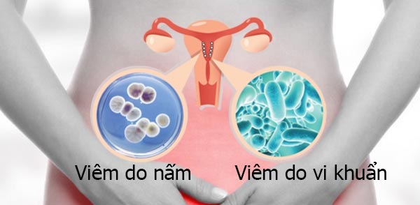 Hậu quả nguy hiểm khi vệ sinh “cô bé” sai cách 1 ve sinh am dao khong dung co the gay benh